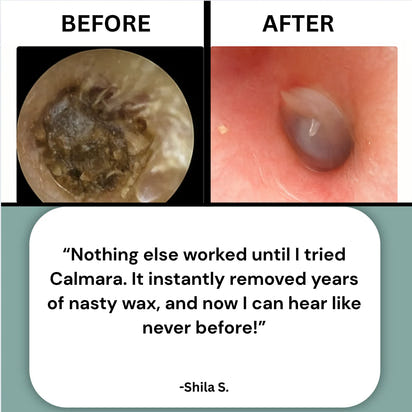 theAsyea™ Ear Wax Remover