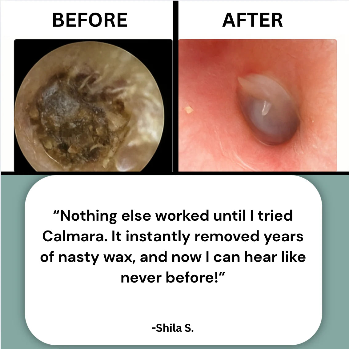 theAsyea™ Ear Wax Remover