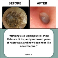 theAsyea™ Ear Wax Remover
