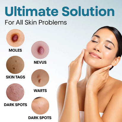 theAsyea ™ Skin Tag & Wart Removal Laser Pen – Safe At-Home Treatment