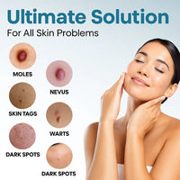 theAsyea ™ Skin Tag & Wart Removal Laser Pen – Safe At-Home Treatment