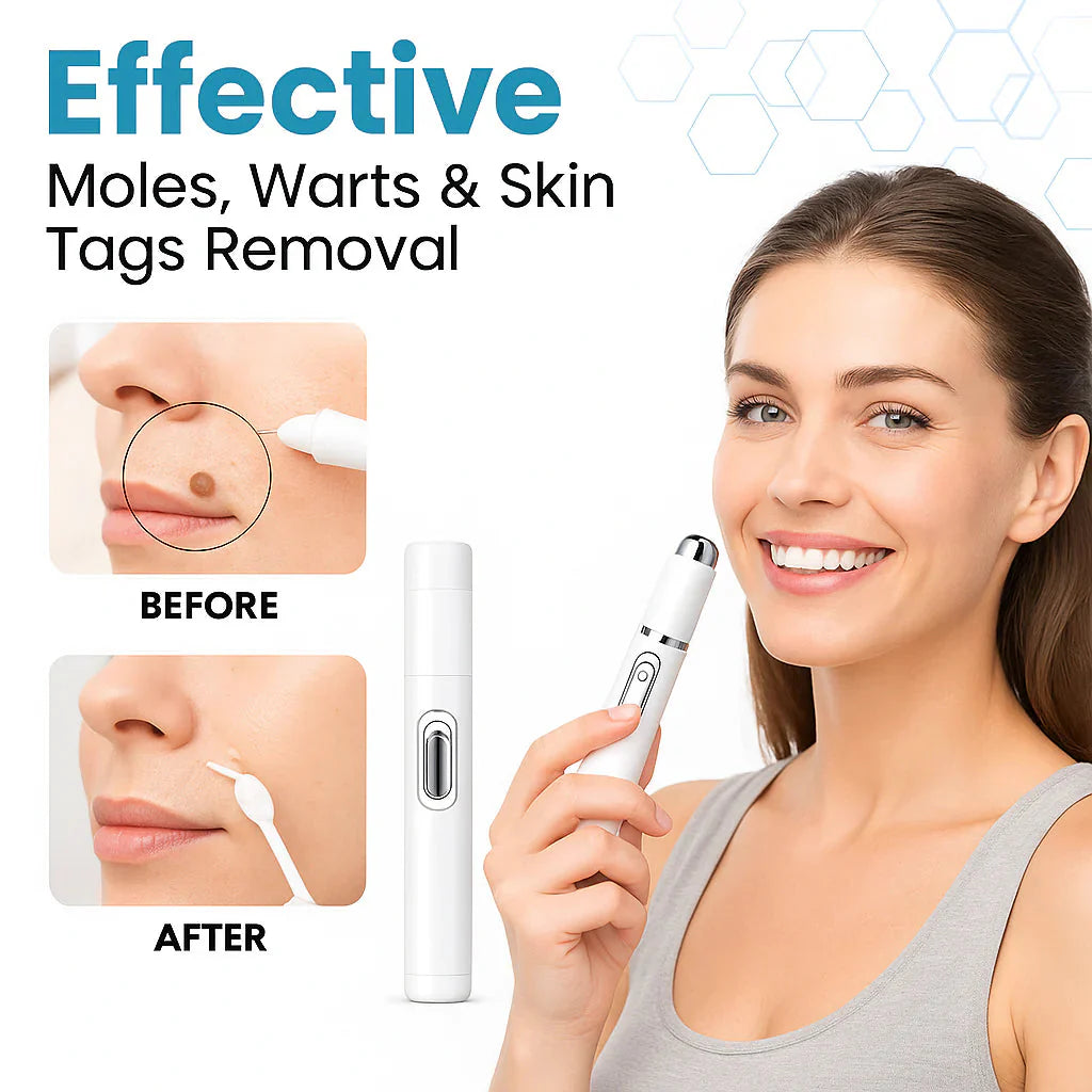 theAsyea ™ Skin Tag & Wart Removal Laser Pen – Safe At-Home Treatment